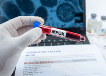 SANTÉ : UN CAS DE MPOX DÉTECTÉ À DAKAR (MSAS)