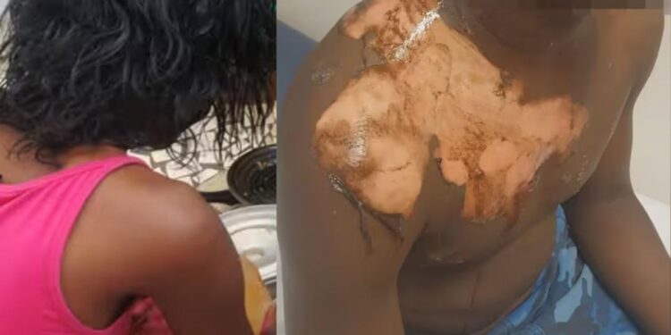 Touba : une femme ébouillante son mari qui envisageait de…